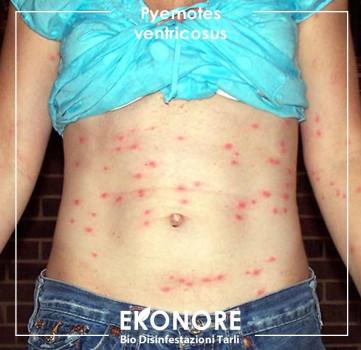 Rimedi e cure contro le punture degli acari dei tarli