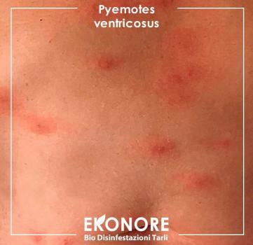 Morsi e punture acari dei tarli pyemotes rimedi