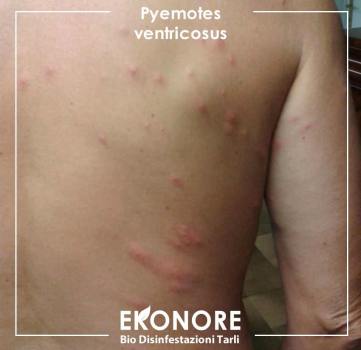 Come riconoscere le punture da acari dei letti e dei tarli del legno