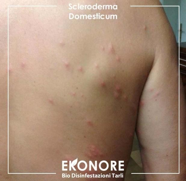 Morsi e punture del parassita dei tarli scleroderma